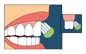 Brossage1[1]