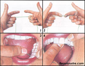 cdcvm_flossing[1]